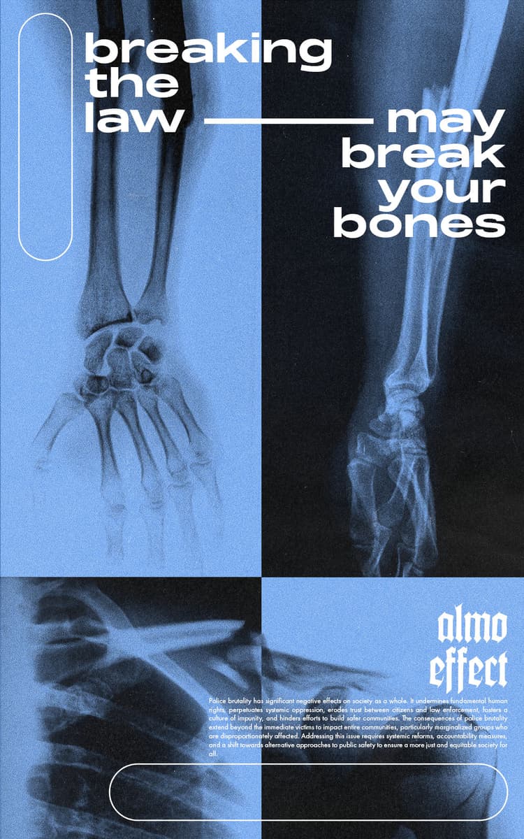 Three X-Ray images of two broken arms and a broken shoulder are composed together in a grid. Two opposite grid parts are both inverted, while the X-Ray having a light blue gradient. On the top half the text ‘breaking the law may break your bones’ is written. Below ‘ALMO EFFECT’ is written in fraktur letters and below that a text regarding police burtality is written: ‘Police brutality has significant negative effects on society as a whole. It undermines fundamental human rights, perpetuates systemic oppression, erodes trust between citizens and law enforcement, fosters a culture of impunity, and hinders efforts to build safer communities. The consequences of police brutality extend beyond the immediate victims to impact entire communities, particularly marginalized groups who are disproportionately affected. Addressing this issue requires systemic reforms, accountability measures, and a shift towards alternative approaches to public safety to ensure a more just and equitable society for all.’